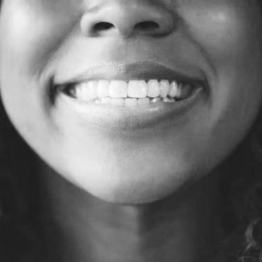 black and white white teeth smile